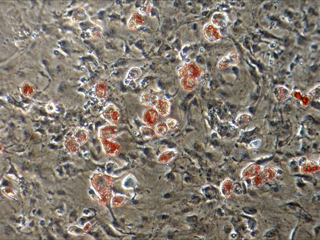A laboratory culture dish shows cells from a pygmy sperm whale forming into fat cells (stained in red) after being exposed to endocrine disruptors in the environment (including oil-derived PAHs). Photo credit: D. Spyropoulos