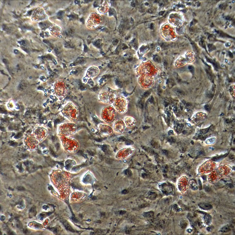 Spyropoulous_FatCellsRed A laboratory culture dish shows cells from a pygmy sperm whale forming into fat cells (stained in red) after being exposed to endocrine disruptors in the environment (including oil-derived PAHs). Photo credit: D. Spyropoulos