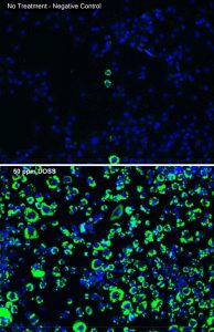 Images were taken from the fluorescent microscope Lexi used to measure the “fatness” of cells. She stained the cells with different colors of fluorescent dyes, which bound to the cell’s triglycerides or nuclei. Computer software linked to a fluorescent microscope counted the photons given off by the dyes to count cells and triglyceride levels. Here, cell nuclei are indicated by blue light and triglycerides are indicated by green light. These images depict cells with no exposure to oil or dispersant (above) and cells exposed to DOSS (below). (Provided by: Lexi Temkin)
