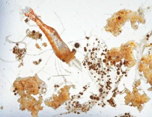 Dispersed oil droplets bound to marine detritus and plankton collected in northern Gulf of Mexico waters during Deepwater Horizon (2010). (Photo courtesy of David Liittschwager)