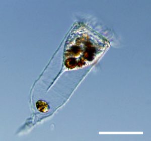 Microscope image of marine tintinnid Favella with ingested dinoflagellates. Scale= 100 um. Credit: R. Almeda