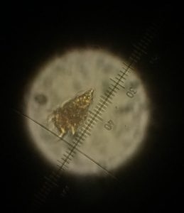 Ph.D. student Chi Hung “Charles” Tang at the University of Texas at Austin captured this microscopic image of a ciliated protistan predator. (Photo credit: Chi Hung Tang)